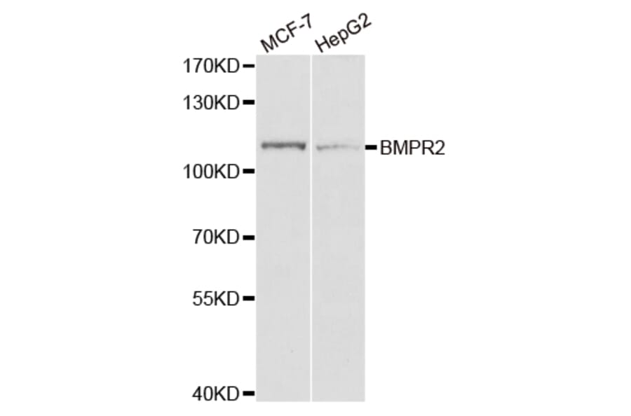 Western blot - BMPR2 Antibody from Signalway Antibody (32961) - Antibodies.com
