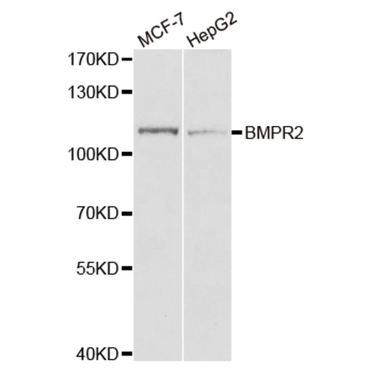 Western blot - BMPR2 Antibody from Signalway Antibody (32961) - Antibodies.com