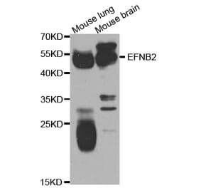 Western blot - EFNB2 Antibody from Signalway Antibody (32963) - Antibodies.com