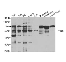 Western blot - HTR2B Antibody from Signalway Antibody (32964) - Antibodies.com