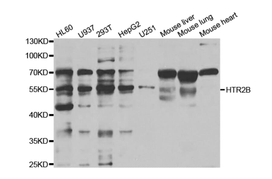 Western blot - HTR2B Antibody from Signalway Antibody (32964) - Antibodies.com