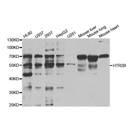 Western blot - HTR2B Antibody from Signalway Antibody (32964) - Antibodies.com