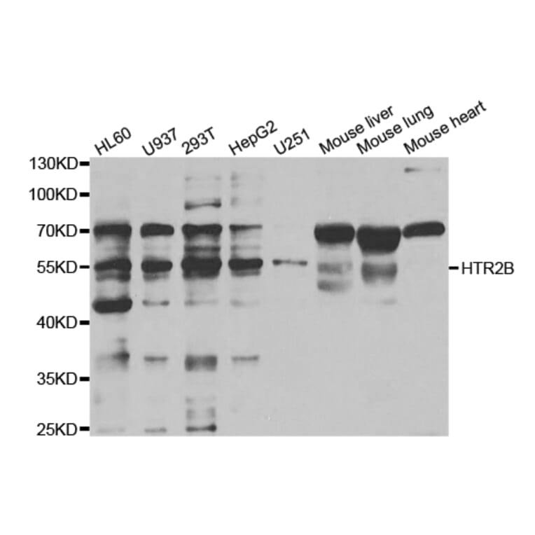 Western blot - HTR2B Antibody from Signalway Antibody (32964) - Antibodies.com