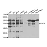 Western blot - HTR2B Antibody from Signalway Antibody (32964) - Antibodies.com