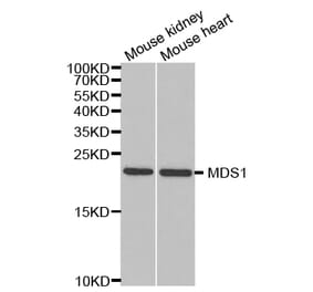 Western blot - MECOM Antibody from Signalway Antibody (32966) - Antibodies.com