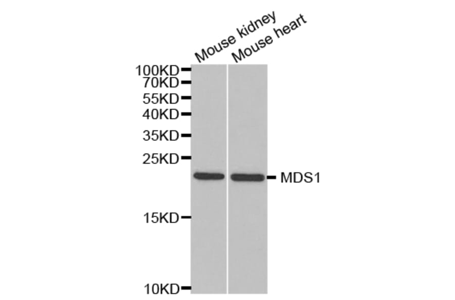Western blot - MECOM Antibody from Signalway Antibody (32966) - Antibodies.com