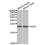 Western blot - MECOM Antibody from Signalway Antibody (32966) - Antibodies.com