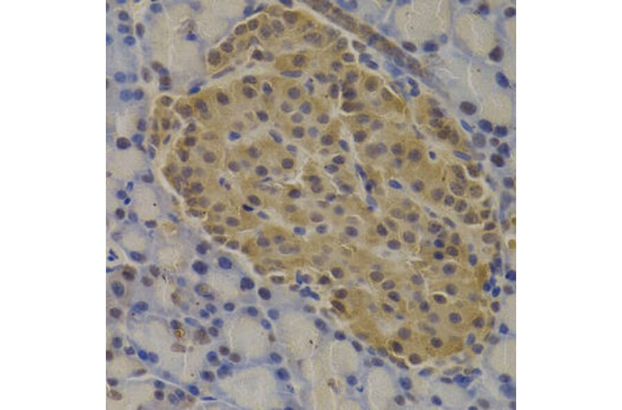 Immunohistochemistry - MECOM Antibody from Signalway Antibody (32966) - Antibodies.com