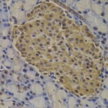 Immunohistochemistry - MECOM Antibody from Signalway Antibody (32966) - Antibodies.com