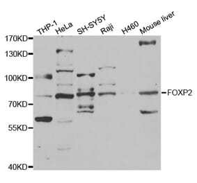 Western blot - FOXP2 Antibody from Signalway Antibody (32969) - Antibodies.com