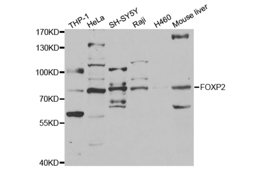 Western blot - FOXP2 Antibody from Signalway Antibody (32969) - Antibodies.com