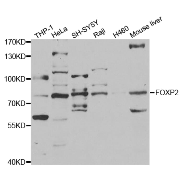 Western blot - FOXP2 Antibody from Signalway Antibody (32969) - Antibodies.com