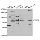 Western blot - FOXP2 Antibody from Signalway Antibody (32969) - Antibodies.com