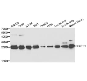 Western blot - GSTP1 Antibody from Signalway Antibody (32978) - Antibodies.com