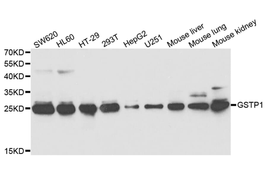 Western blot - GSTP1 Antibody from Signalway Antibody (32978) - Antibodies.com