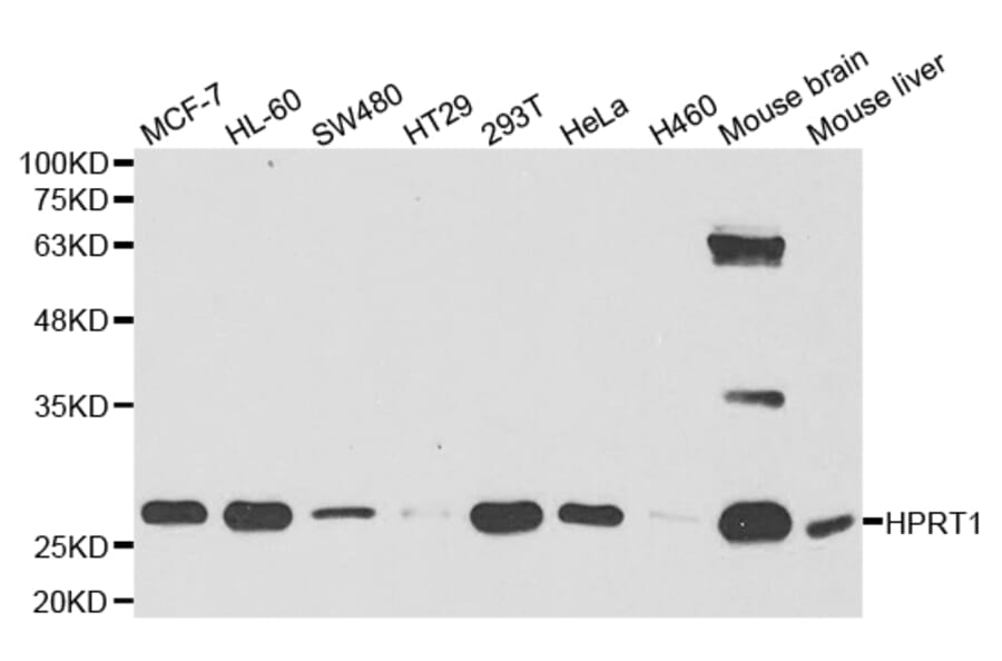 Western blot - HPRT1 Antibody from Signalway Antibody (32979) - Antibodies.com