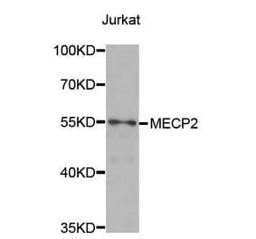 Western blot - MECP2 Antibody from Signalway Antibody (32980) - Antibodies.com