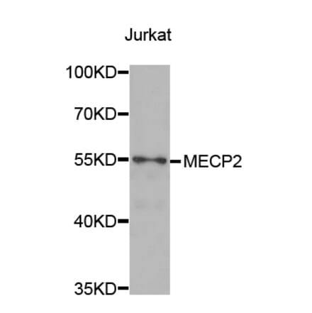 Western blot - MECP2 Antibody from Signalway Antibody (32980) - Antibodies.com