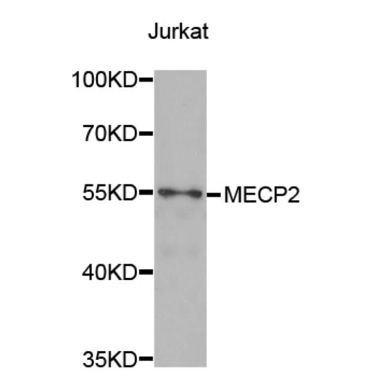 Western blot - MECP2 Antibody from Signalway Antibody (32980) - Antibodies.com