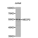 Western blot - MECP2 Antibody from Signalway Antibody (32980) - Antibodies.com