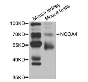 Western blot - NCOA4 Antibody from Signalway Antibody (32981) - Antibodies.com