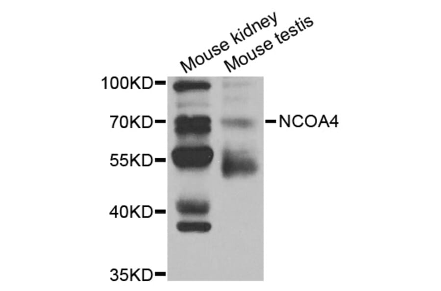 Western blot - NCOA4 Antibody from Signalway Antibody (32981) - Antibodies.com