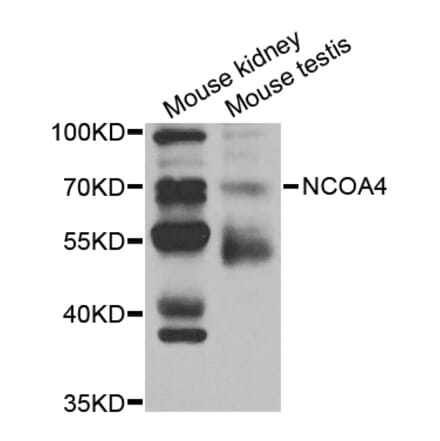 Western blot - NCOA4 Antibody from Signalway Antibody (32981) - Antibodies.com