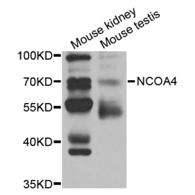 Western blot - NCOA4 Antibody from Signalway Antibody (32981) - Antibodies.com