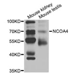 Western blot - NCOA4 Antibody from Signalway Antibody (32981) - Antibodies.com