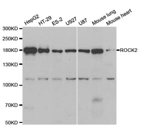 Western blot - ROCK2 Antibody from Signalway Antibody (32984) - Antibodies.com