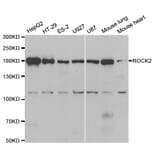 Western blot - ROCK2 Antibody from Signalway Antibody (32984) - Antibodies.com
