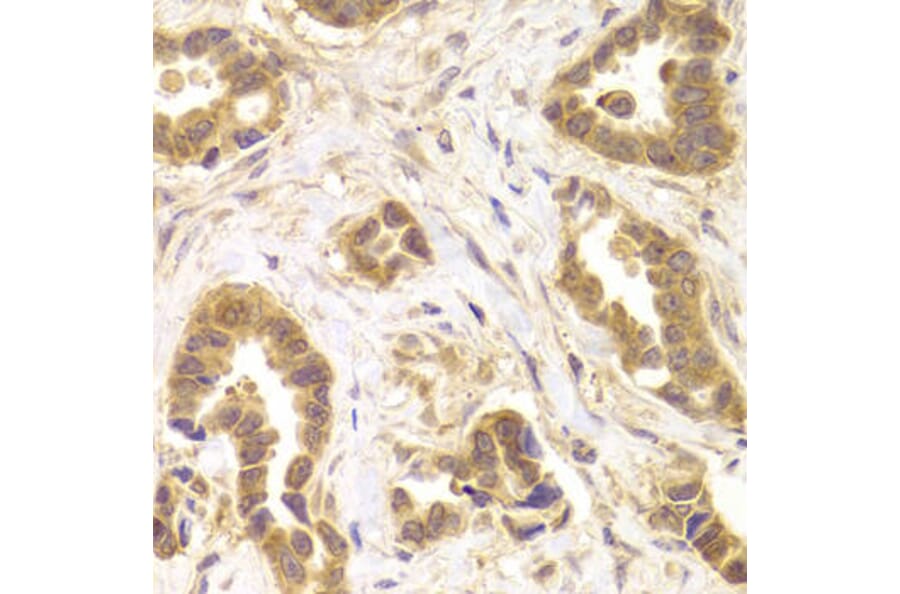 Immunohistochemistry - ROCK2 Antibody from Signalway Antibody (32984) - Antibodies.com