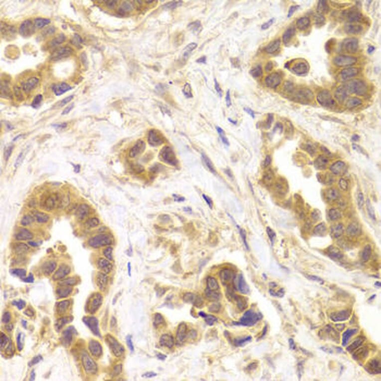 Immunohistochemistry - ROCK2 Antibody from Signalway Antibody (32984) - Antibodies.com