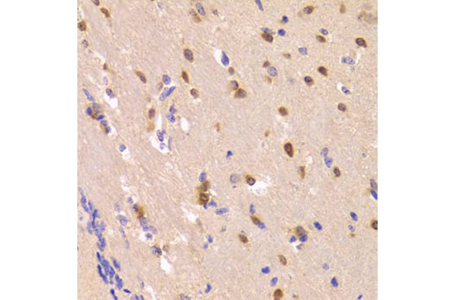Immunohistochemistry - ROCK2 Antibody from Signalway Antibody (32984) - Antibodies.com