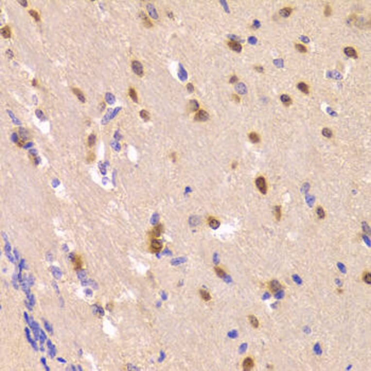 Immunohistochemistry - ROCK2 Antibody from Signalway Antibody (32984) - Antibodies.com