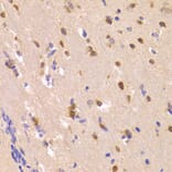 Immunohistochemistry - ROCK2 Antibody from Signalway Antibody (32984) - Antibodies.com