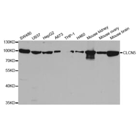 Western blot - CLCN5 Antibody from Signalway Antibody (32987) - Antibodies.com