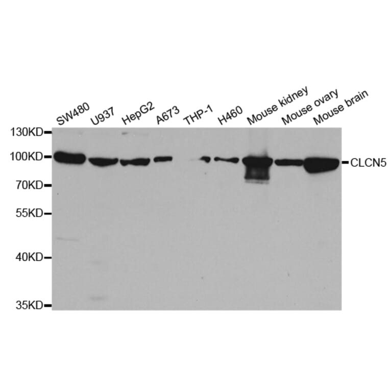 Western blot - CLCN5 Antibody from Signalway Antibody (32987) - Antibodies.com