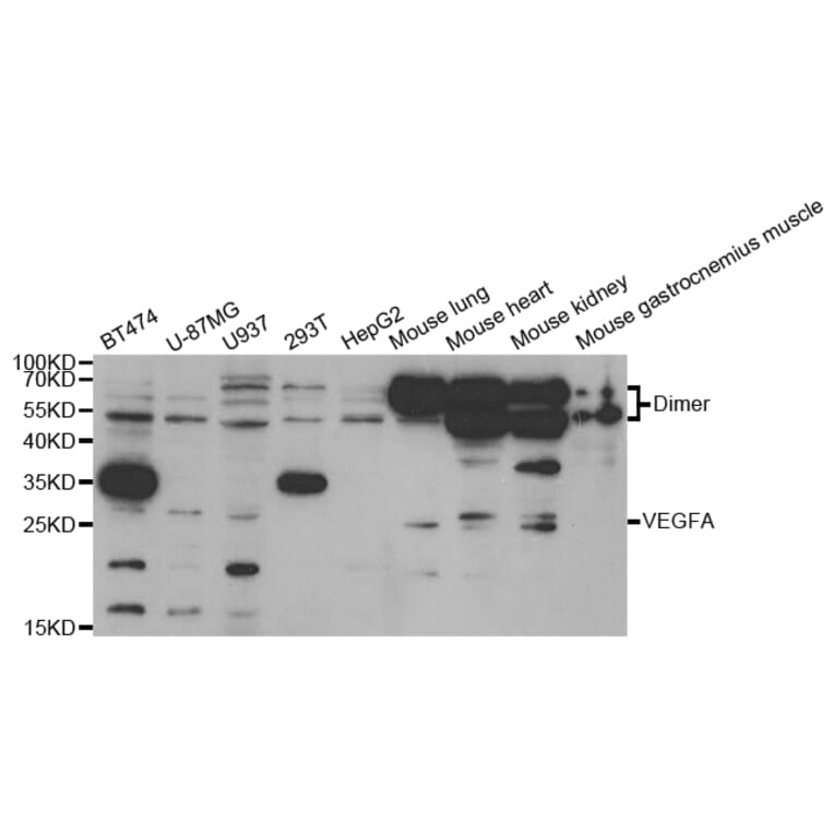 Western blot - VEGFA Antibody from Signalway Antibody (32988) - Antibodies.com