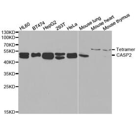 Western blot - CASP2 Antibody from Signalway Antibody (32995) - Antibodies.com