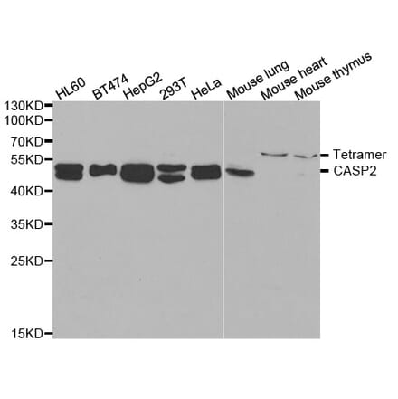 Western blot - CASP2 Antibody from Signalway Antibody (32995) - Antibodies.com