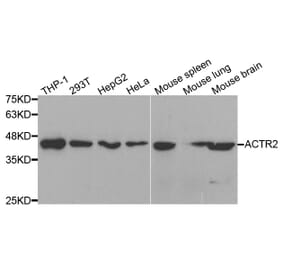 Western blot - ACTR2 Antibody from Signalway Antibody (33001) - Antibodies.com