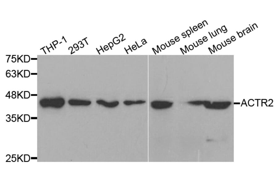 Anti-ACTR2 Antibody (A37650) | Antibodies.com