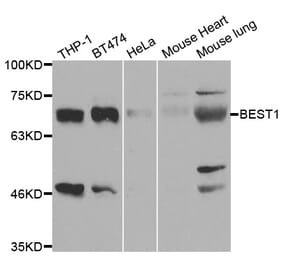 Western blot - BEST1 Antibody from Signalway Antibody (33002) - Antibodies.com