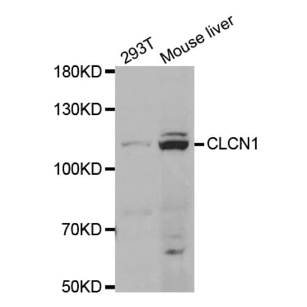 Western blot - CLCN1 Antibody from Signalway Antibody (33005) - Antibodies.com