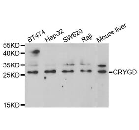 Western blot - CRYGD Antibody from Signalway Antibody (33006) - Antibodies.com