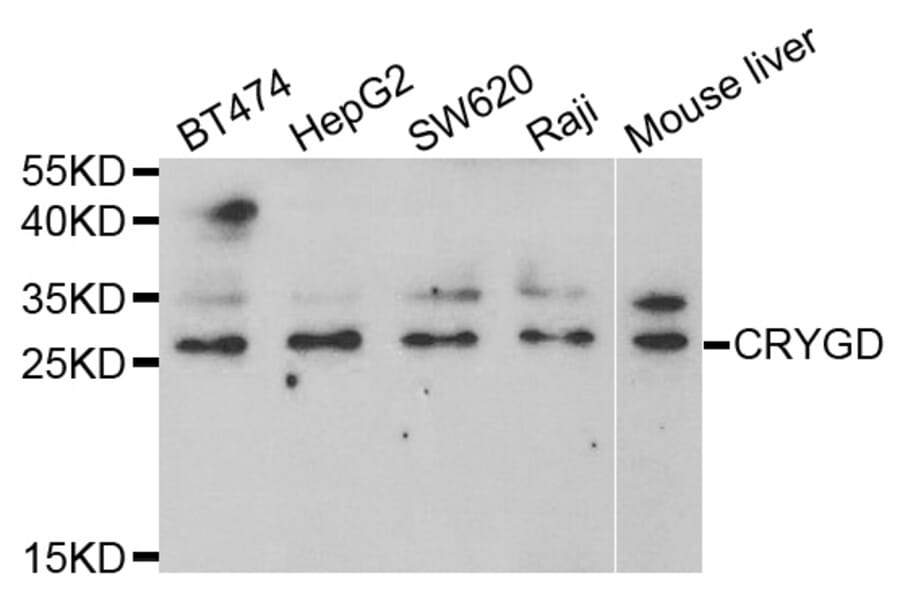 Western blot - CRYGD Antibody from Signalway Antibody (33006) - Antibodies.com