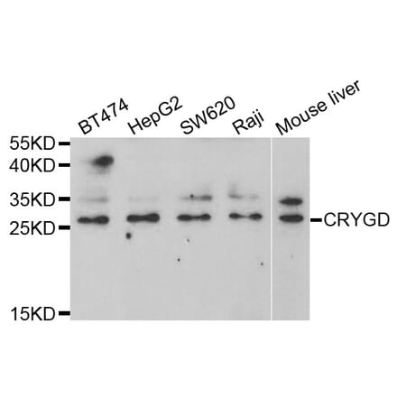 Western blot - CRYGD Antibody from Signalway Antibody (33006) - Antibodies.com