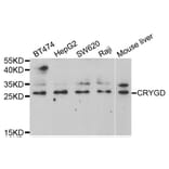 Western blot - CRYGD Antibody from Signalway Antibody (33006) - Antibodies.com