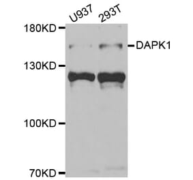 Western blot - DAPK1 Antibody from Signalway Antibody (33007) - Antibodies.com